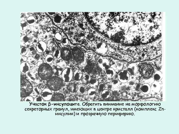 Участок β-инсулоцита. Обратить внимание на морфологию секреторных гранул, имеющих в центре кристалл (комплекс Znинсулин)