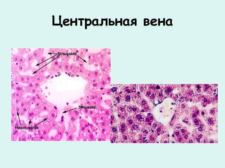 Центральная вена 