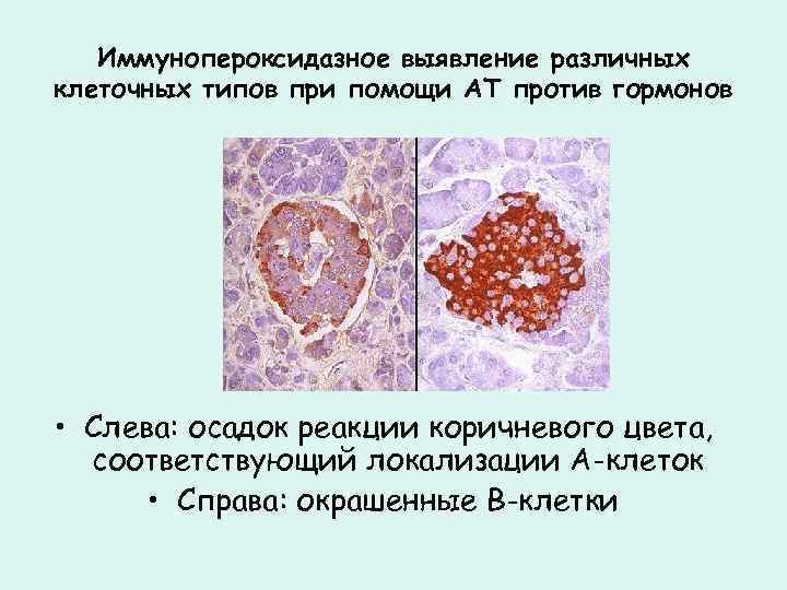 Иммунопероксидазное выявление различных клеточных типов при помощи АТ против гормонов • Слева: осадок реакции