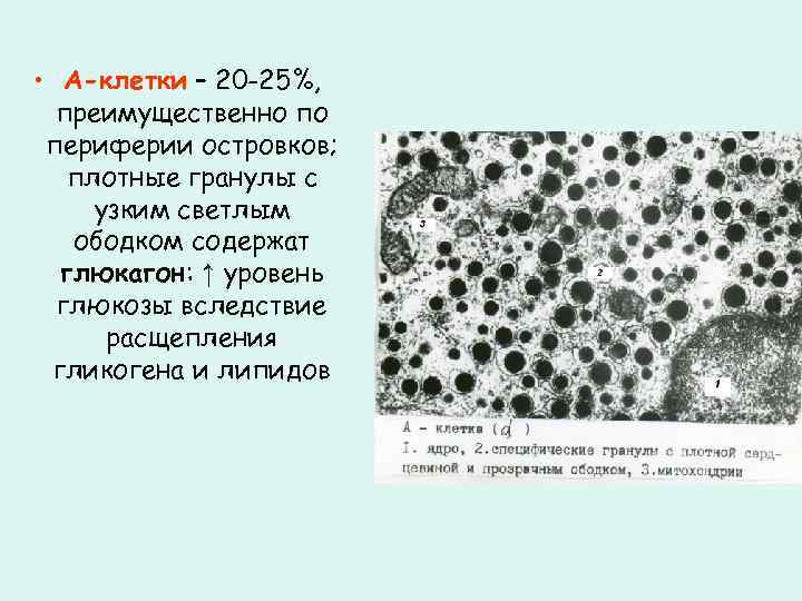  • А-клетки – 20 -25%, преимущественно по периферии островков; плотные гранулы с узким