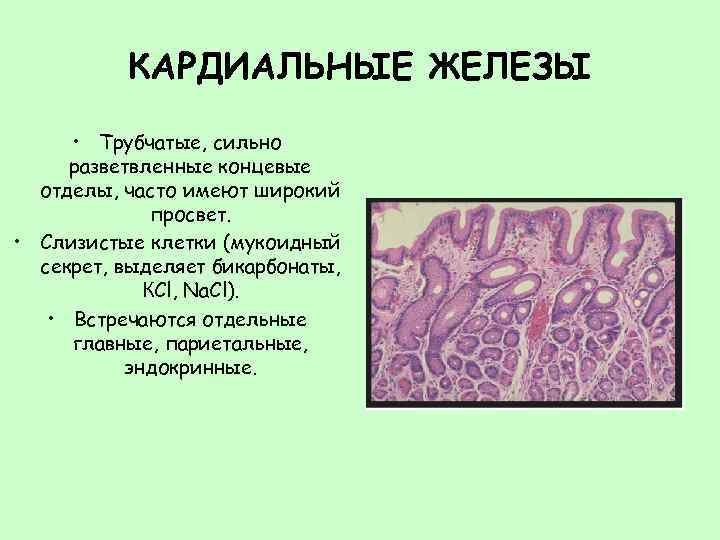 Слизистые клетки секрет. Кардиальные железы желудка гистология. Клетки железы желудка гистология. Кардинальные делещы желудка. Пилорические железы гистология.