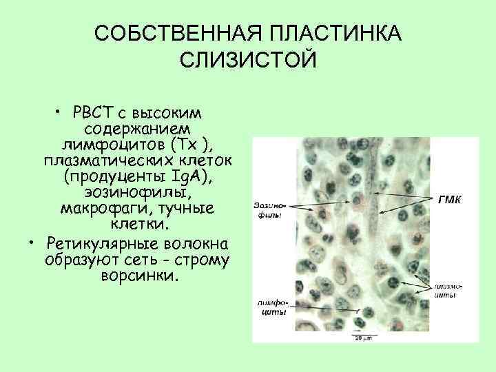СОБСТВЕННАЯ ПЛАСТИНКА СЛИЗИСТОЙ • РВСТ с высоким содержанием лимфоцитов (Тх ), плазматических клеток (продуценты