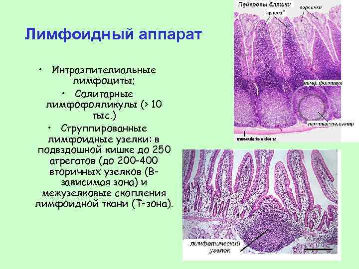 Схема строения пейеровой бляшки