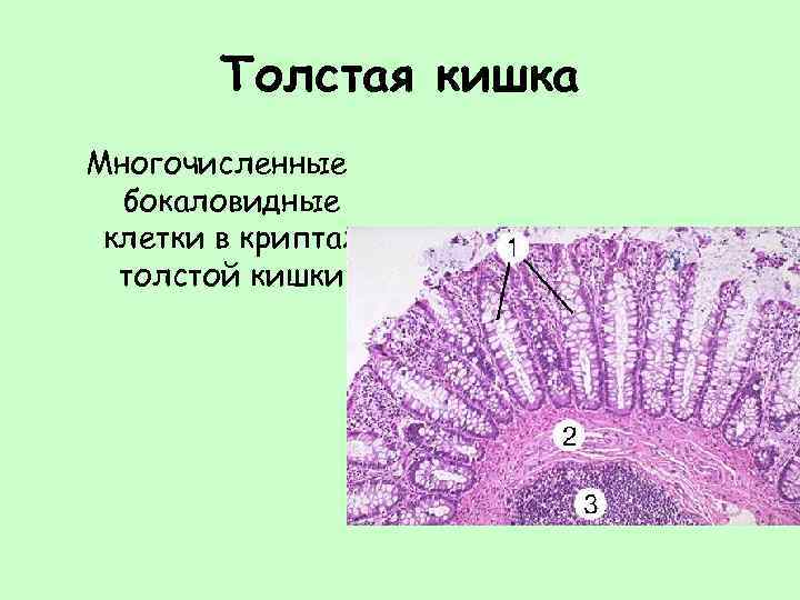 Бокаловидные клетки. Бокаловидные клетки препарат. Бокаловидные клетки кишечника гистология. Бокаловидные клетки толстой кишки гистология. Бокаловидная клетка гистология.