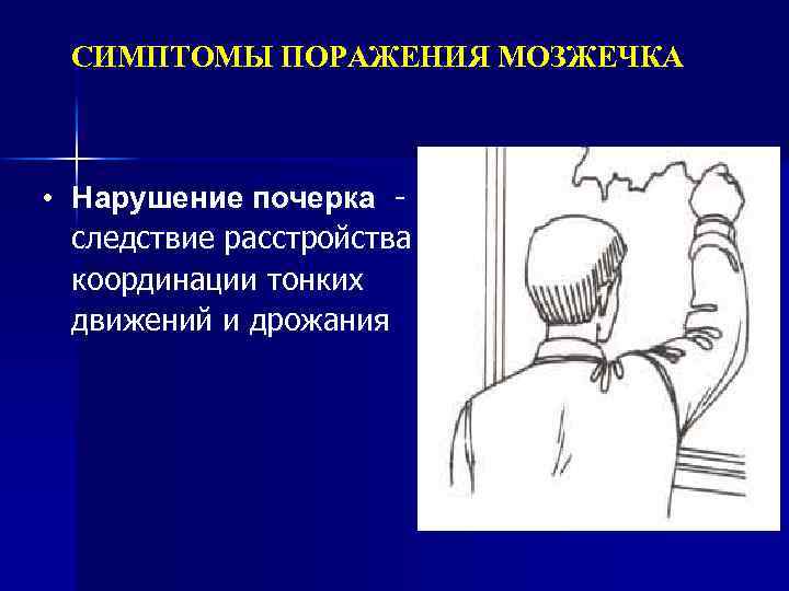 Травма мозжечка может привести к нарушению. Почерк при поражении мозжечка. Травма мозжечка. Симптомы расстройства мозжечка. Симптомы нарушения мозжечка.