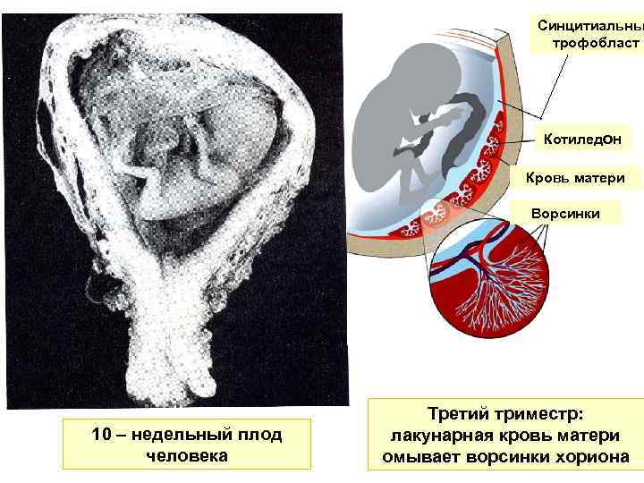 Синцитиальны трофобласт Котиледон Кровь матери Ворсинки 10 – недельный плод человека Третий триместр: лакунарная