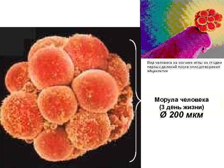 Морула человека (3 день жизни) Ø 200 мкм 