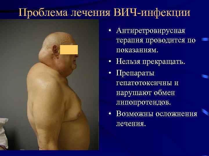 Проблема лечения ВИЧ-инфекции • Антиретровирусная терапия проводится по показаниям. • Нельзя прекращать. • Препараты
