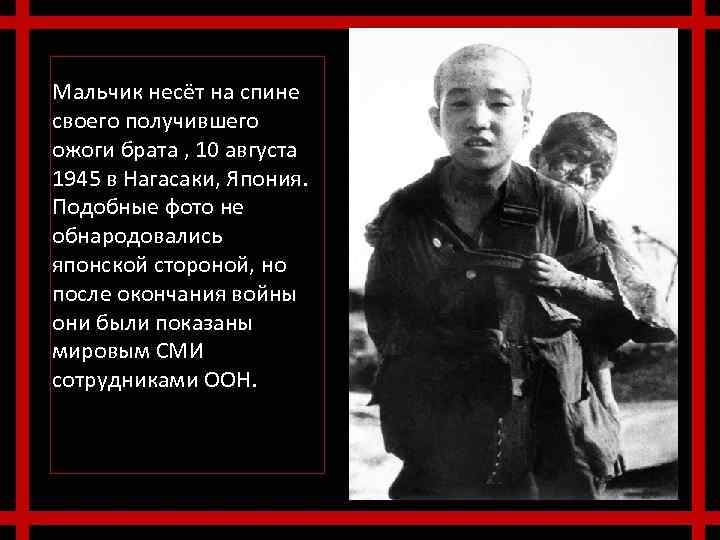 Мальчик несёт на спине своего получившего ожоги брата , 10 августа 1945 в Нагасаки,