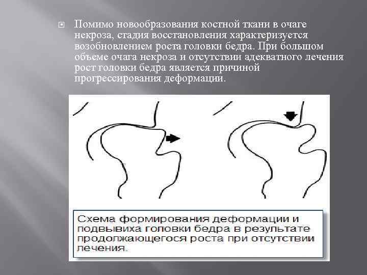  Помимо новообразования костной ткани в очаге некроза, стадия восстановления характеризуется возобновлением роста головки