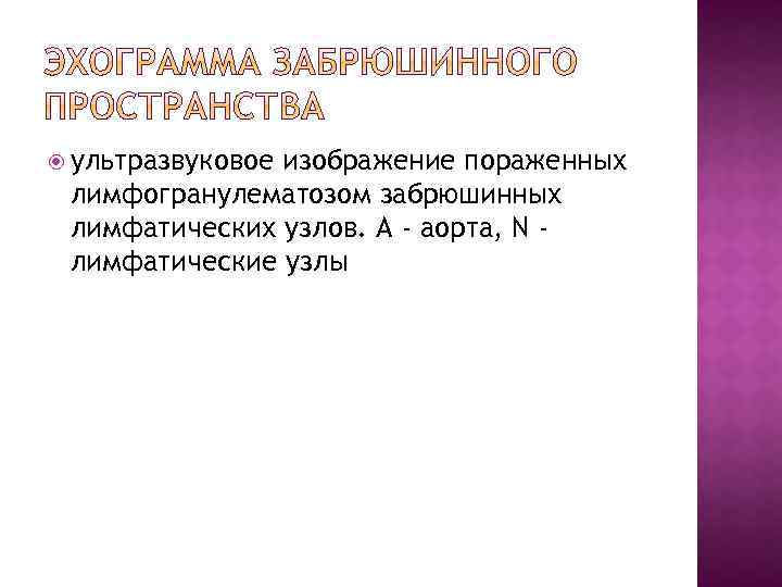  ультразвуковое изображение пораженных лимфогранулематозом забрюшинных лимфатических узлов. А - аорта, N лимфатические узлы