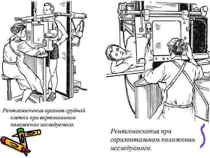 Рентгеноскопия органов грудной клетки при вертикальном положении исследуемого. Рентгеноскопия при горизонтальном положении исследуемого. 