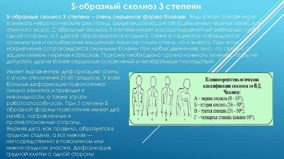 S-образный сколиоз 3 степени – очень серьезная форма болезни. Ведь в этом случае могут