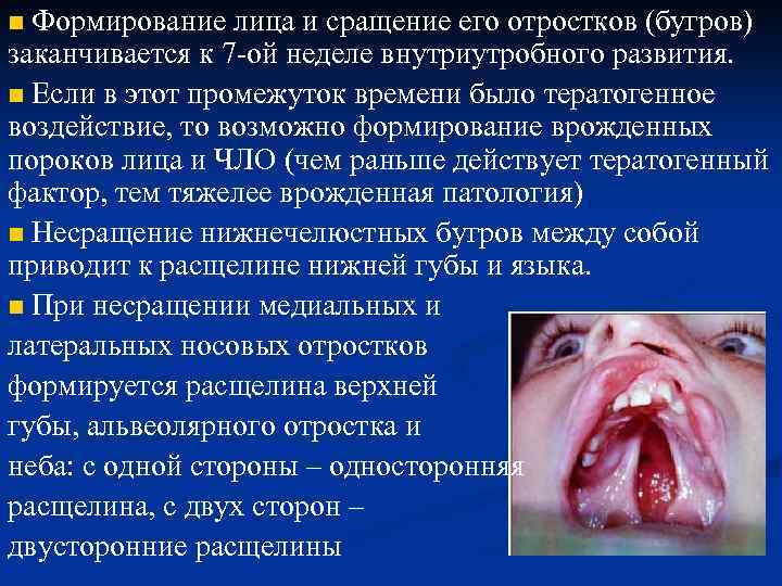 n Формирование лица и сращение его отростков (бугров) заканчивается к 7 -ой неделе внутриутробного
