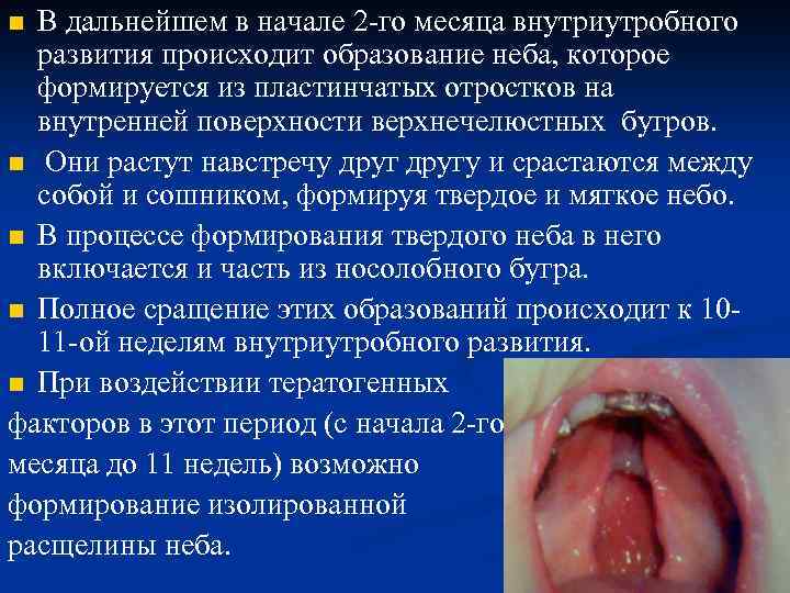 В дальнейшем в начале 2 -го месяца внутриутробного развития происходит образование неба, которое формируется