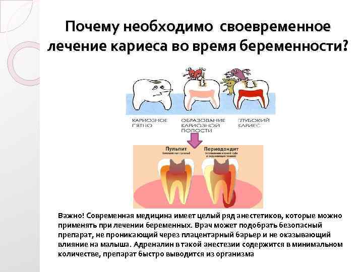 Почему необходимо своевременное лечение кариеса во время беременности? Важно! Современная медицина имеет целый ряд