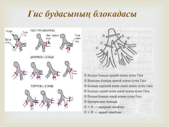 Гис будасының блокадасы 