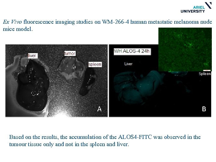 Ex Vivo fluorescence imaging studies on WM-266 -4 human metastatic melanoma nude mice model.