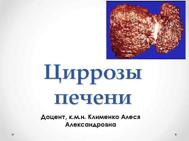 Циррозы печени Доцент, к. м. н. Клименко Алеся Александровна 