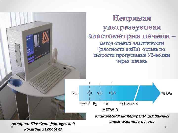 Непрямая ультразвуковая эластометрия печени – метод оценки эластичности (плотности в к. Па) органа по