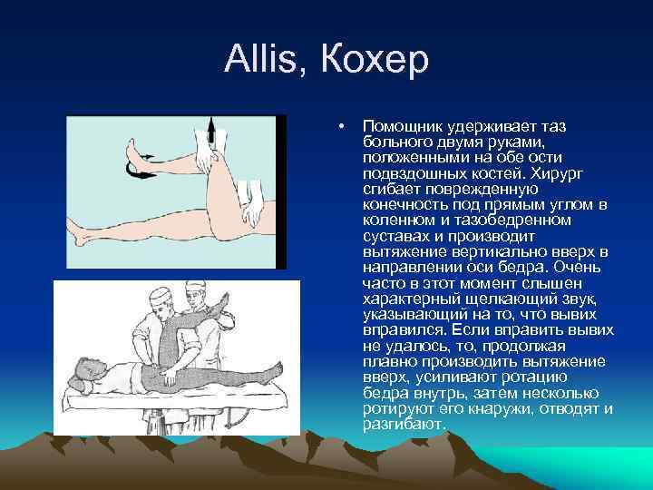 Allis, Кохер • Помощник удерживает таз больного двумя руками, положенными на обе ости подвздошных