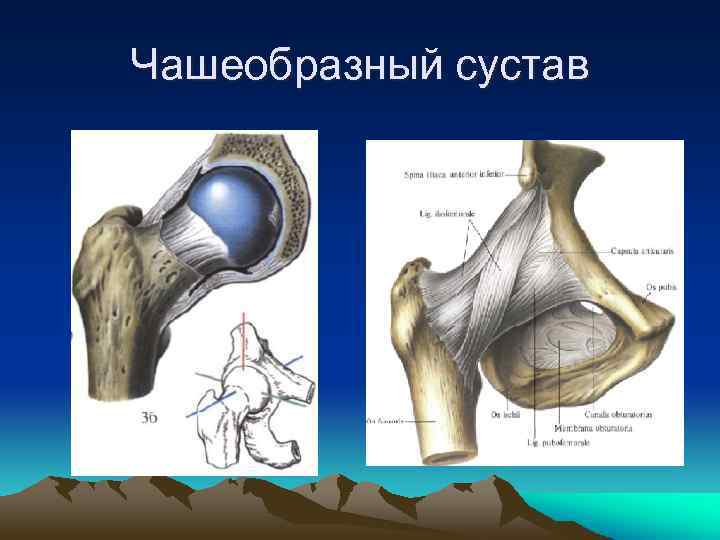 Врожденный вывих бедра презентация травматология