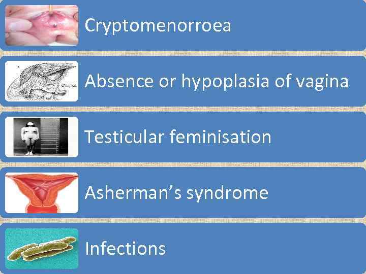 Cryptomenorroea Absence or hypoplasia of vagina Testicular feminisation Asherman’s syndrome Infections 