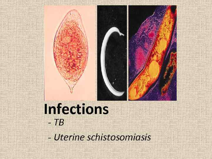 Infections - TB - Uterine schistosomiasis 