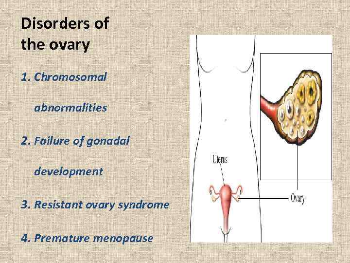 Disorders of the ovary 1. Chromosomal abnormalities 2. Failure of gonadal development 3. Resistant