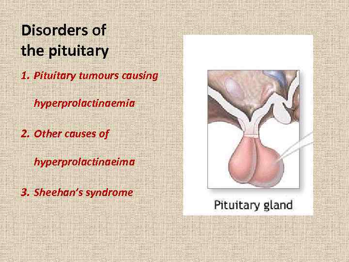 Disorders of the pituitary 1. Pituitary tumours causing hyperprolactinaemia 2. Other causes of hyperprolactinaeima