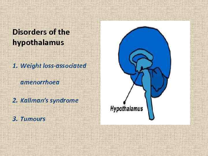 Disorders of the hypothalamus 1. Weight loss-associated amenorrhoea 2. Kallman’s syndrome 3. Tumours 