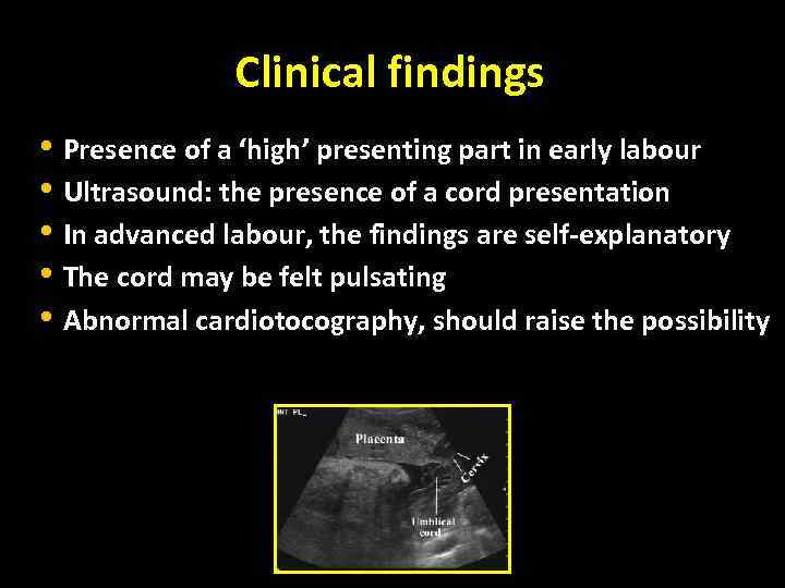 Clinical findings • Presence of a ‘high’ presenting part in early labour • Ultrasound:
