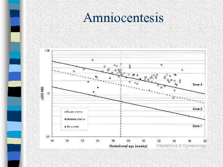 Amniocentesis 