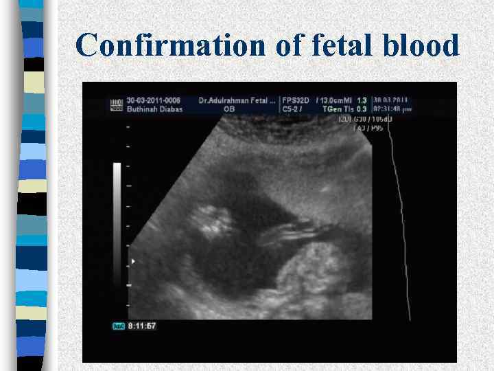 Confirmation of fetal blood 