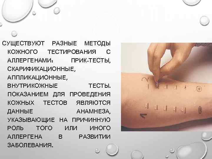 СУЩЕСТВУЮТ РАЗНЫЕ МЕТОДЫ КОЖНОГО ТЕСТИРОВАНИЯ С АЛЛЕРГЕНАМИ: ПРИК-ТЕСТЫ, СКАРИФИКАЦИОННЫЕ, АППЛИКАЦИОННЫЕ, ВНУТРИКОЖНЫЕ ТЕСТЫ. ПОКАЗАНИЕМ ДЛЯ