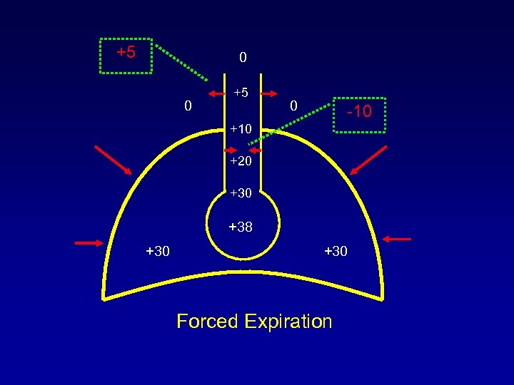 +5 0 0 +5 0 -10 +20 +38 +30 Forced Expiration 