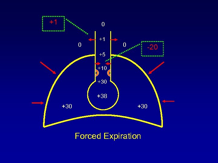 +1 0 0 +1 0 -20 +5 +10 +38 +30 Forced Expiration 