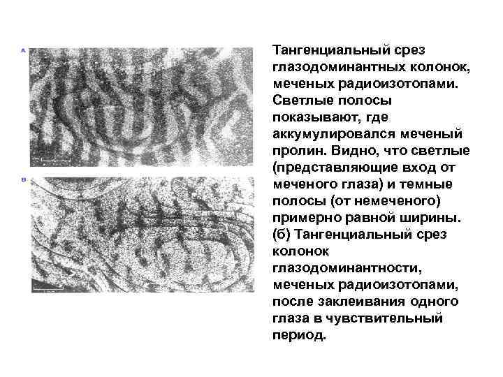 Тангенциальный срез глазодоминантных колонок, меченых радиоизотопами. Светлые полосы показывают, где аккумулировался меченый пролин. Видно,