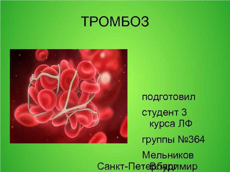 ТРОМБОЗ подготовил студент 3 курса ЛФ группы № 364 Мельников Санкт-Петербург Владимир 