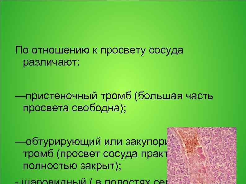 По отношению к просвету сосуда различают: —пристеночный тромб (большая часть просвета свободна); —обтурирующий или