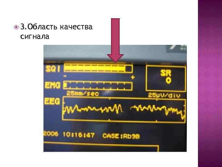  3. Область сигнала качества 