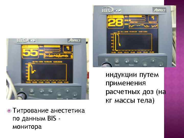 индукции путем применения расчетных доз (на кг массы тела) Титрование анестетика по данным BIS