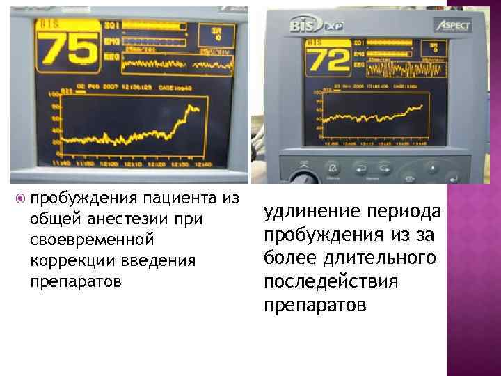  пробуждения пациента из общей анестезии при своевременной коррекции введения препаратов удлинение периода пробуждения