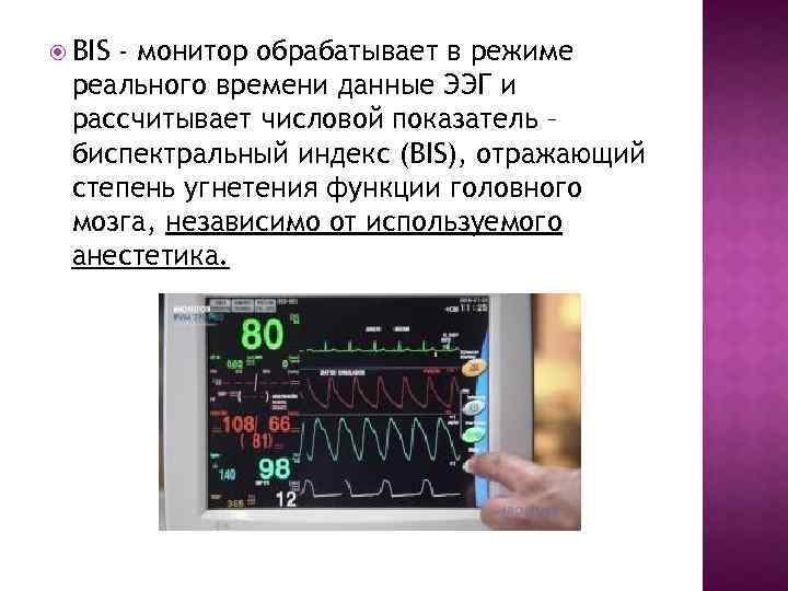  BIS - монитор обрабатывает в режиме реального времени данные ЭЭГ и рассчитывает числовой