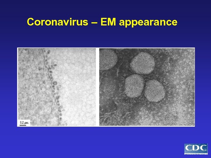 Coronavirus – EM appearance 