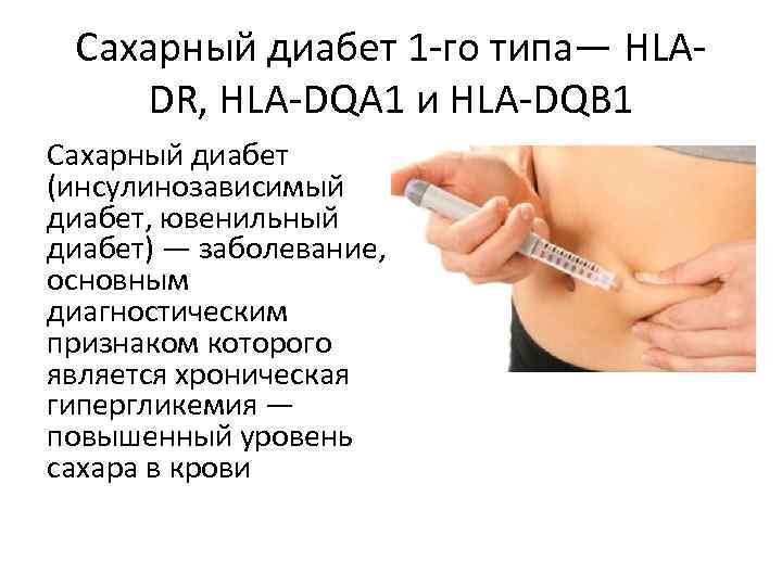 Сахарный диабет 1 -го типа— HLADR, HLA-DQA 1 и HLA-DQB 1 Сахарный диабет (инсулинозависимый