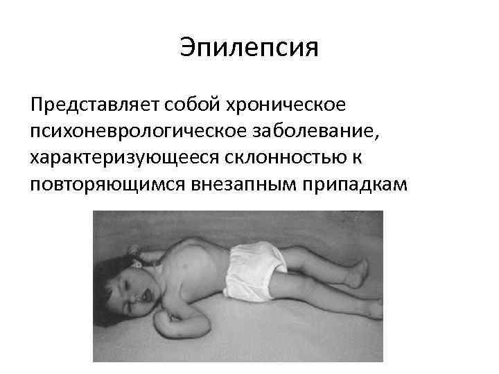 Эпилепсия Представляет собой хроническое психоневрологическое заболевание, характеризующееся склонностью к повторяющимся внезапным припадкам 