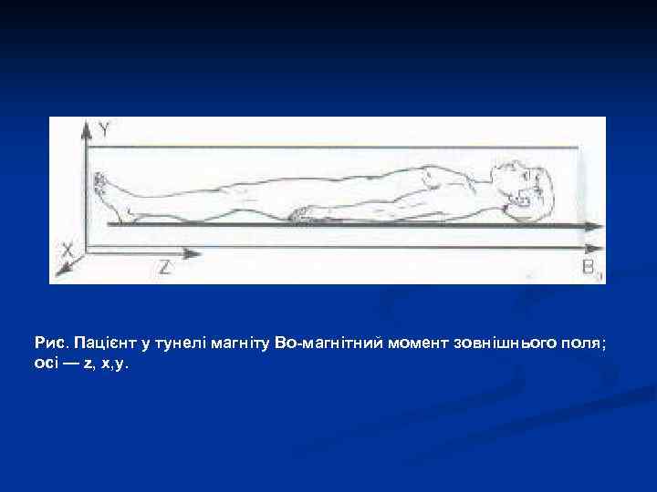 Рис. Пацієнт у тунелі магніту Во-магнітний момент зовнішнього поля; осі — z, х, у.