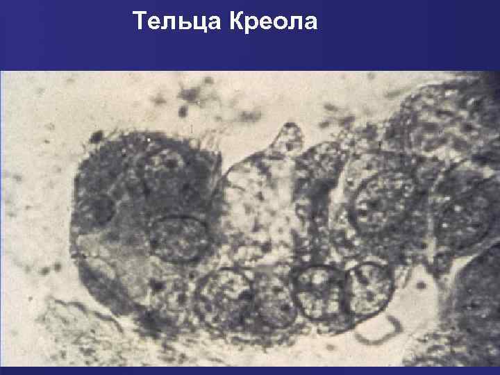 Тельца Креола 