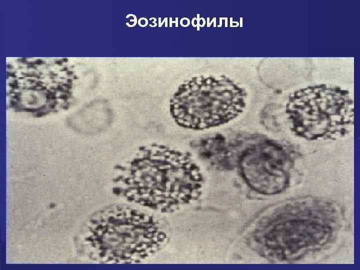 Эозинофилы 